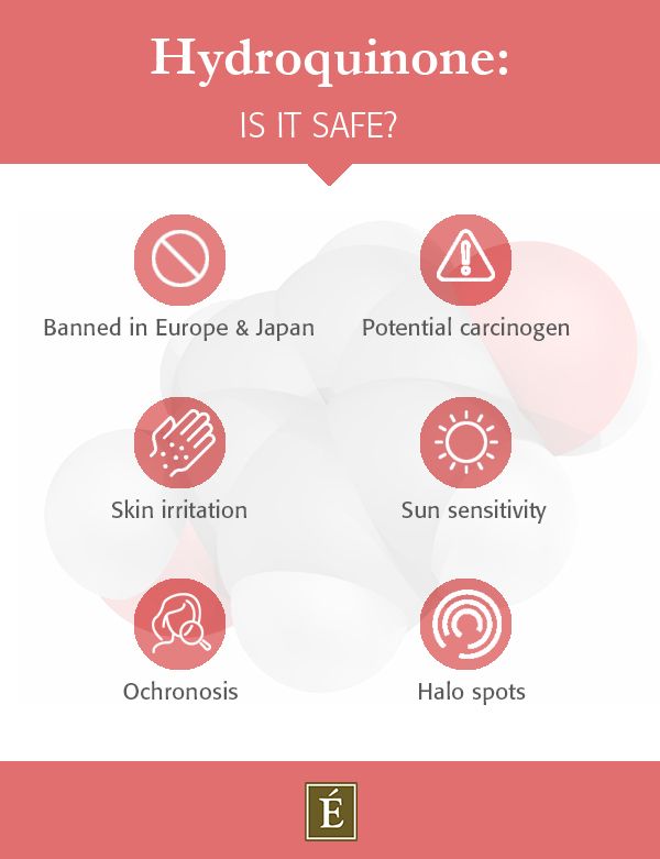 Hydroquinone: Is It Safe? infographic