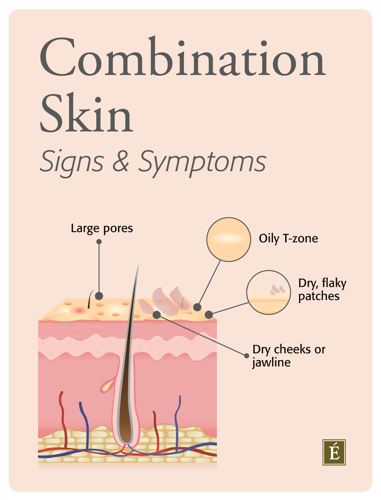 Combination Skin Signs and Symptoms Infographic