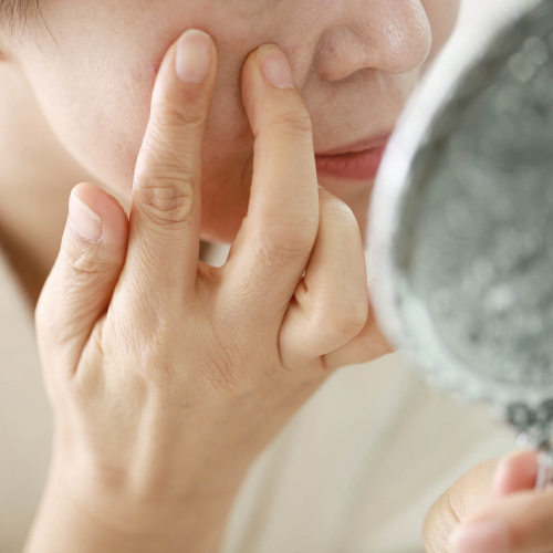 Woman checking for pimples