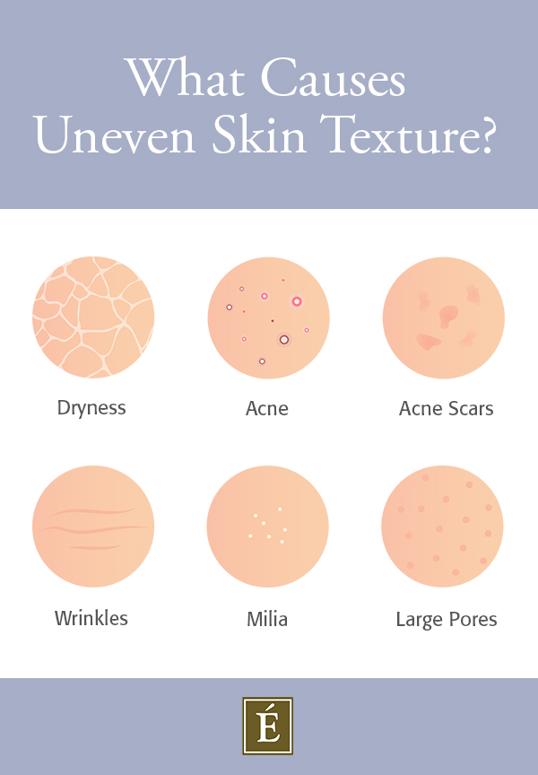 Causes of uneven skin texture inforgraphic