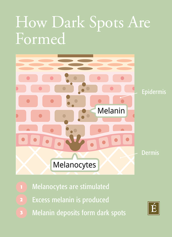 how dark spots are formed graphic