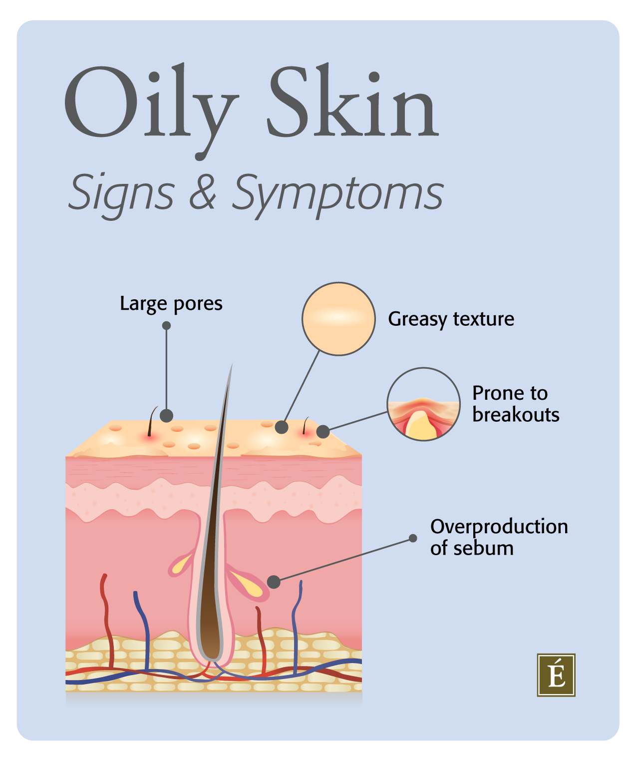 oily skin infographic