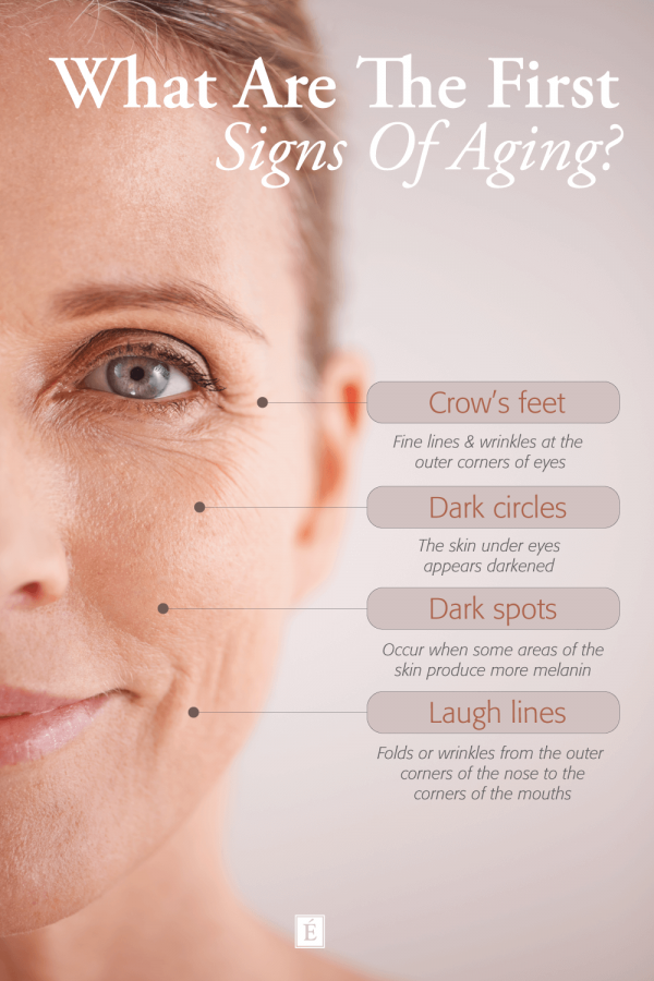 What are the first signs of aging? Infographic