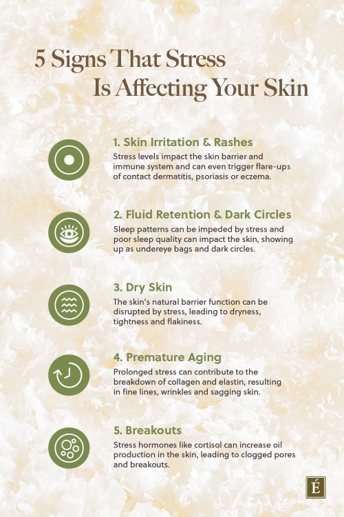 Infographic listing 5 reasons stress is affecting skin