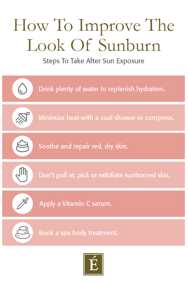 ow to improve the look of sunburn infographi