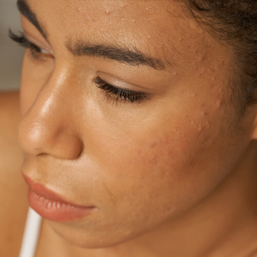 a close-up of a woman's face