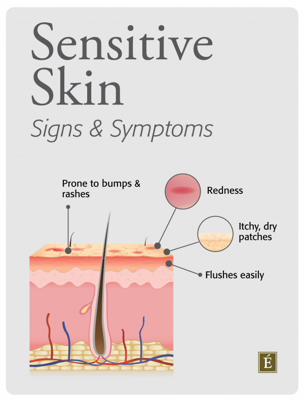 Sensitive Skin Infographic