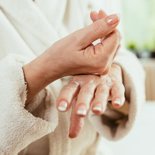 Woman with dry hands