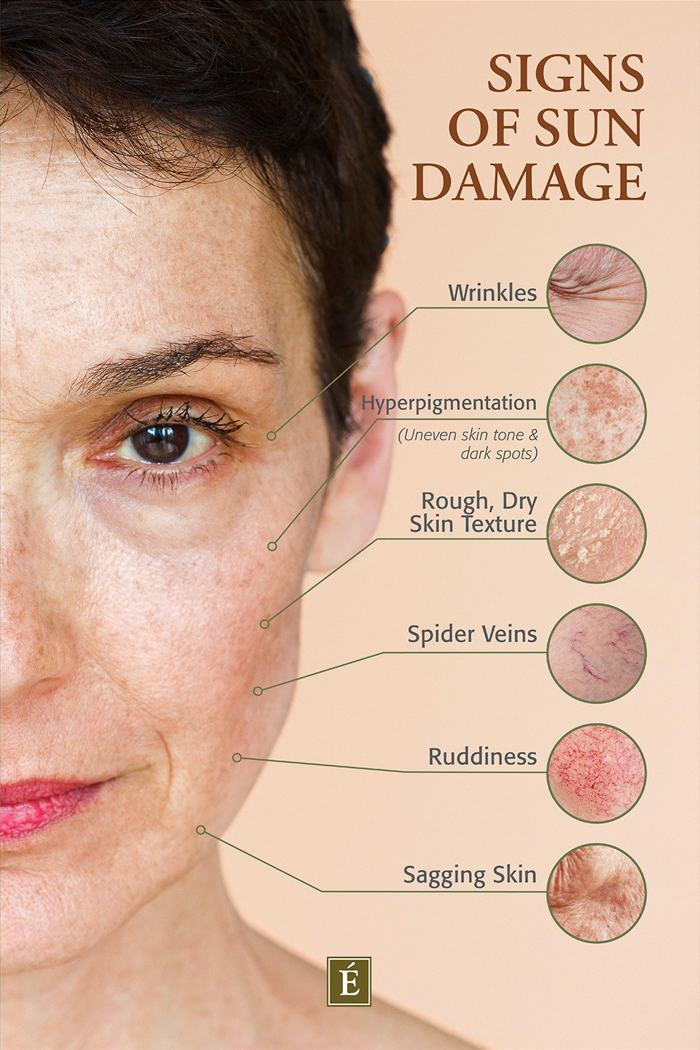 signs of sun damage infographic